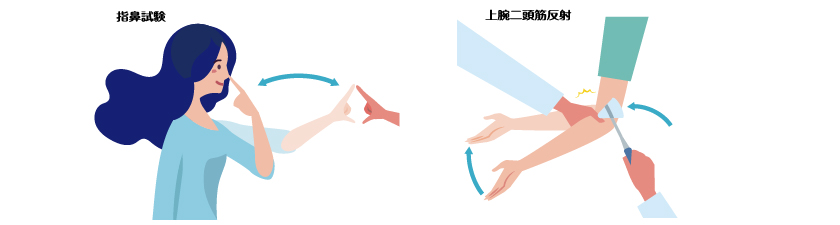 運動機能検査、指鼻試験と上腕二頭筋反射のイメージ図。