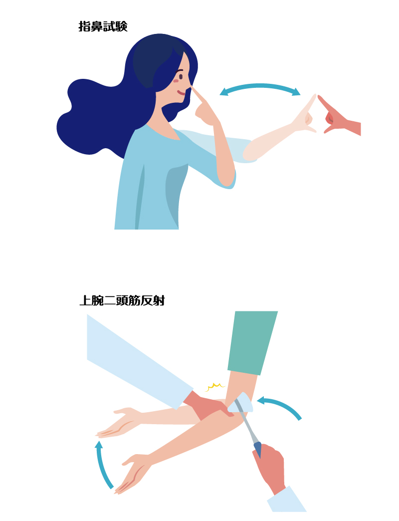 運動機能検査、指鼻試験と上腕二頭筋反射のイメージ図。